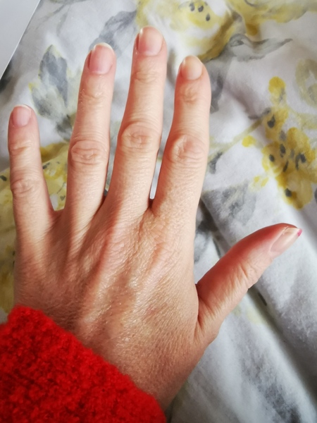 Does anyone want to play 'guess the age of my hands?