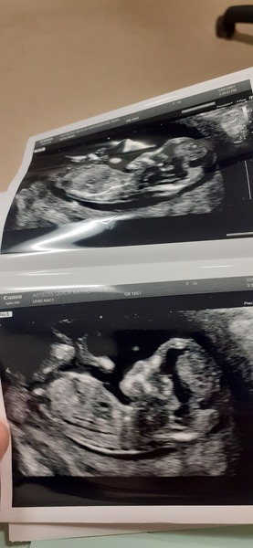 chances of having all the same gender?