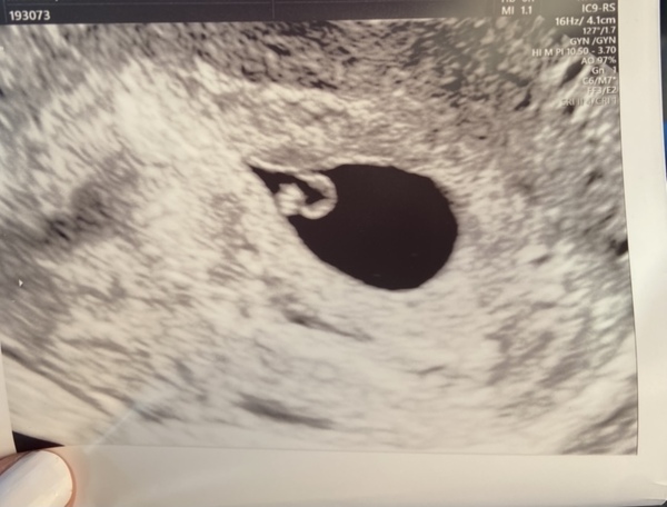 First baby due September 2021