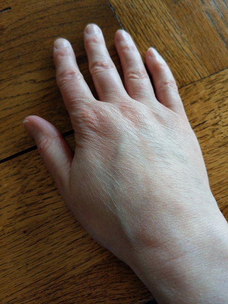 Does anyone want to play 'guess the age of my hands?