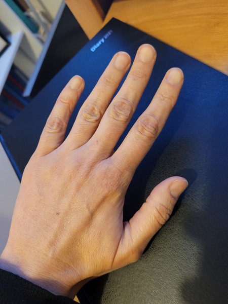 Does anyone want to play 'guess the age of my hands?