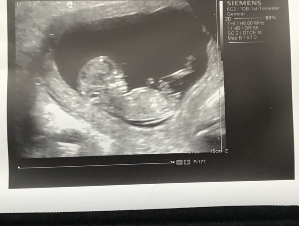 TTC after MC - Dec/Jan 2020 (Thread 16)