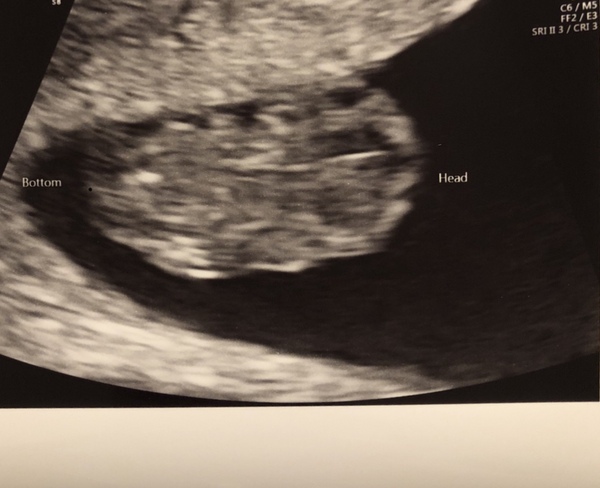 3x Due Aug 21 consolidated