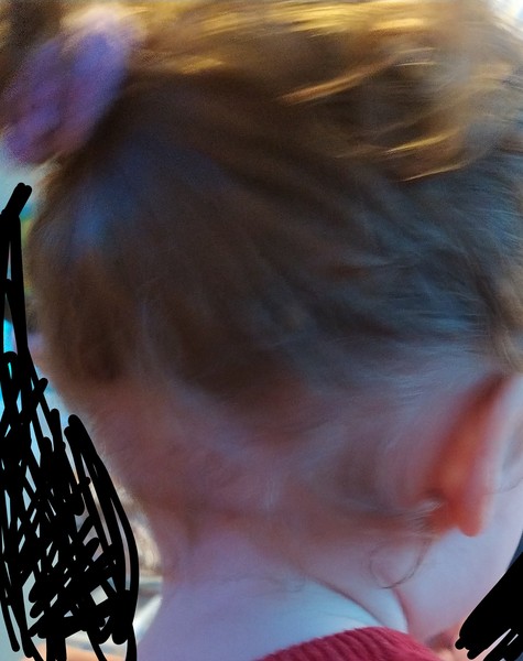Is my toddlers hair normal? (Pic)