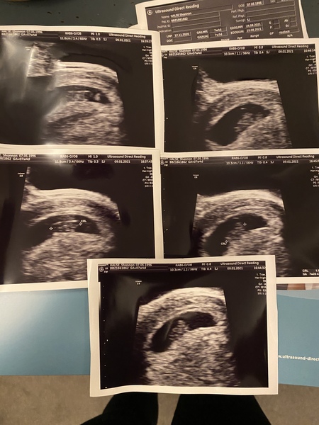 BFP - due August 2021