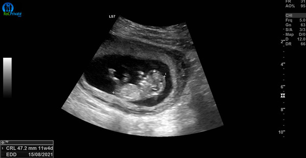 First baby due September 2021
