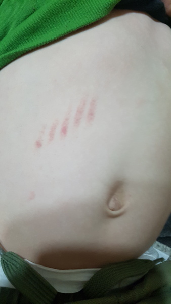 Bruises/scratches on DS, can I have your take please?