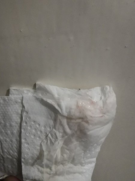 TMI photo warning. A pink tinge, 1 week late