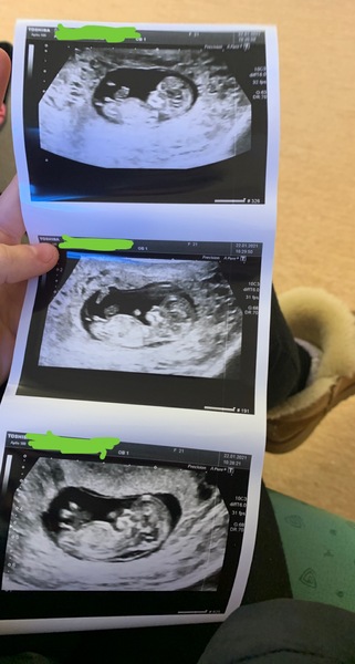 Gender guess