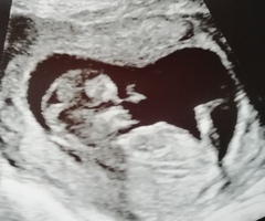 Gender guess - skull/nub?