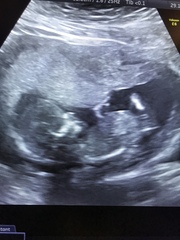 Do you want me to guess the sex? 12 week scans.