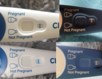 10dpo - symptoms but bfn