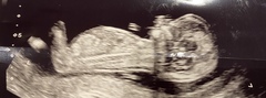 Do you want me to guess the sex? 12 week scans.