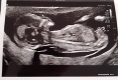 Any gender guesses please