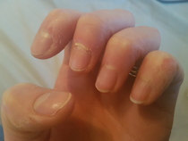 Help with my nails please! (Pics attached)