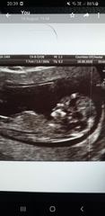 Boy or Girl!?
