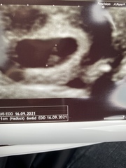 Tracking your cycle and possible BFP using RHR - part 5