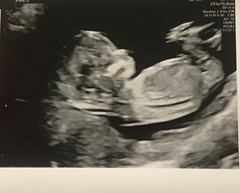 Do you want me to guess the sex? 12 week scans.