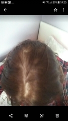 What is happening to my hair??