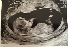 Pre-conception, planning and trying!