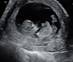 August 2021 - Scans and booking in!