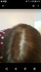 What is happening to my hair??