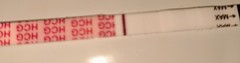 4DPO