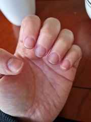 Help with my nails please! (Pics attached)