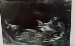 Do you want me to guess the sex? 12 week scans.