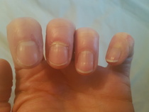 Help with my nails please! (Pics attached)