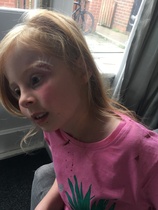 Child injury *pic attached* - does this look well done?