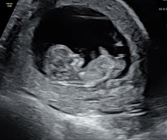 August 2021 - Scans and booking in!