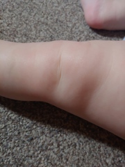 9 month old with deep dimples everywhere.