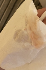 Bleeding one day after heatbeat on scan GRAPHIC