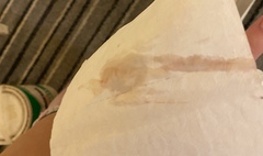 Bleeding one day after heatbeat on scan GRAPHIC