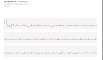 Can someone have a look at my ECG please?