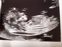 Any gender guesses please