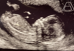 Do you want me to guess the sex? 12 week scans.