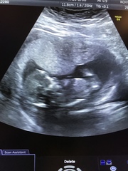 Do you want me to guess the sex? 12 week scans.