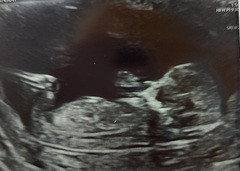 Gender guess?