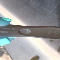 10dpo - symptoms but bfn
