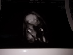 IVF graduates due Summer 2021