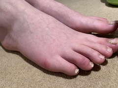 Covid Toes?