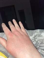 Does anyone want to play 'guess the age of my hands?