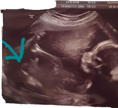 Boy or Girl!?