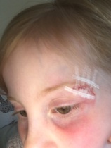 Child injury *pic attached* - does this look well done?