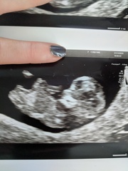 Do you want me to guess the sex? 12 week scans.