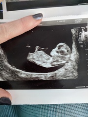Do you want me to guess the sex? 12 week scans.
