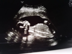 IVF graduates due Summer 2021