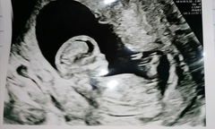 Do you want me to guess the sex? 12 week scans.